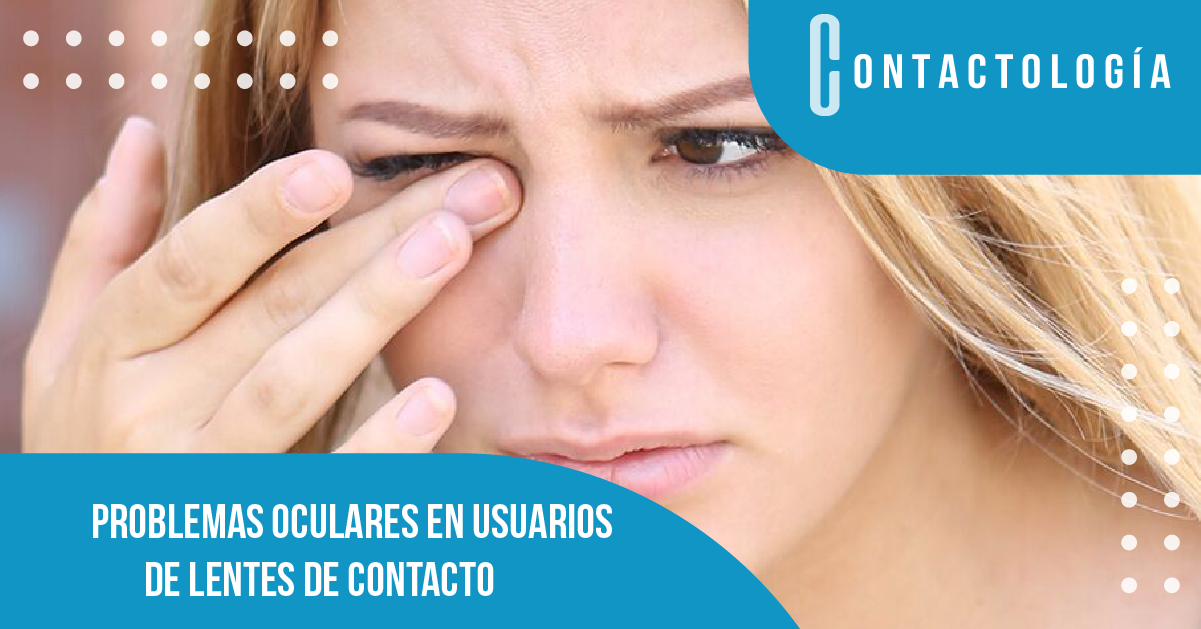 Problemas oculares en usuarios de lentes de contacto